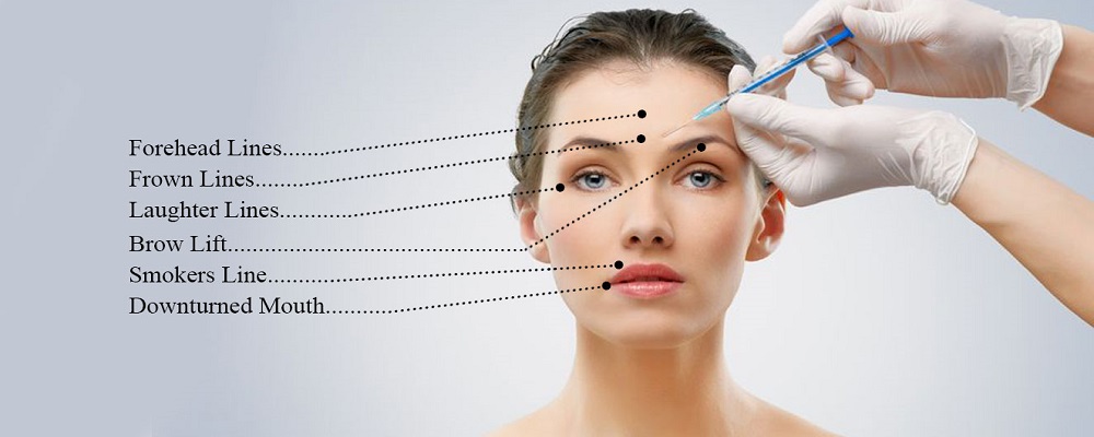 anti wrinkle injections at best clinic near me