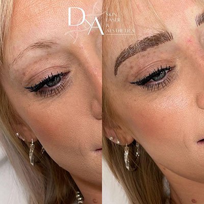 Microblading Experts Near Me in London
