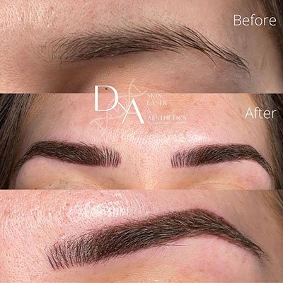 Semi-permanent brow makeup at DNA Aesthetics Clinic in South East London