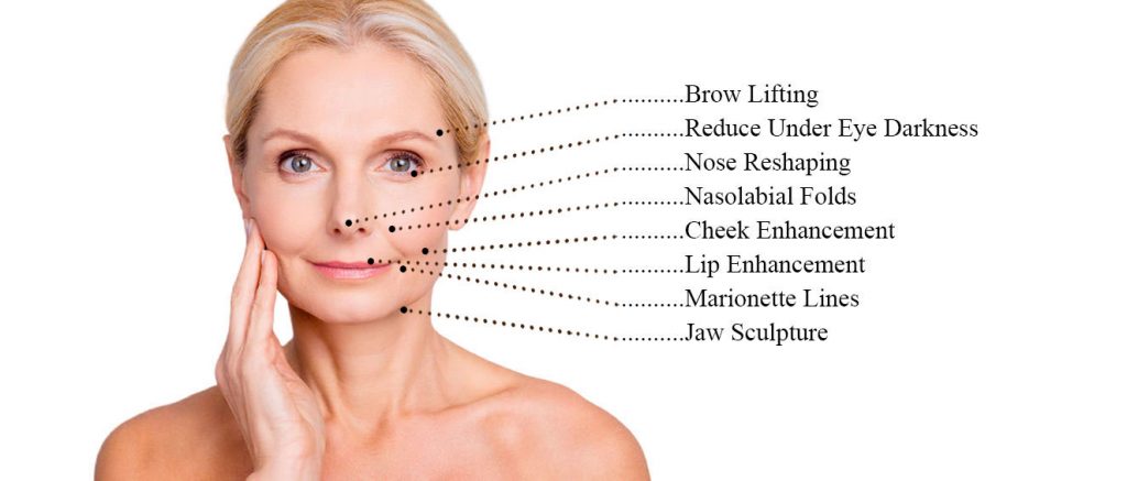 Dermal Fillers at DNA Skin Laser Aesthetics Clinic in Canada Water, South East London