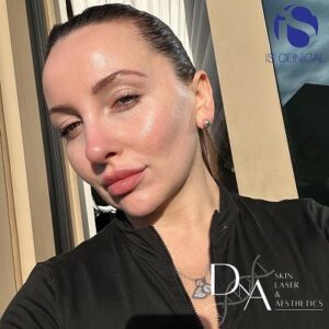 Best Facials at DNA Aesthetics Clinic in Canada Water