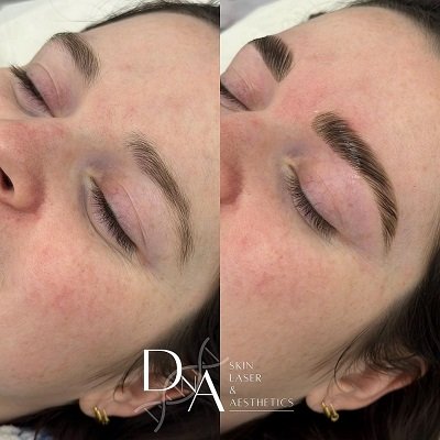 “No-Makeup” Makeup Treatments