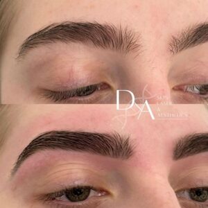 Brow Shaping at DNA Aesthetics Clinic in London