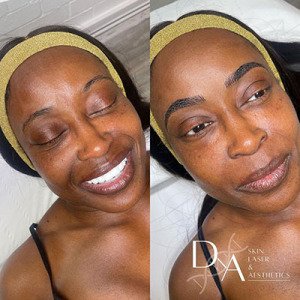 Microbladed-Brows-at-DNA-Skin-Beauty-Salon-in-Canada-Water-SE-London