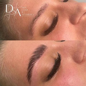 Microblading-at-Canada-Waters-best-beauty-salon-DNA-Aeshetics